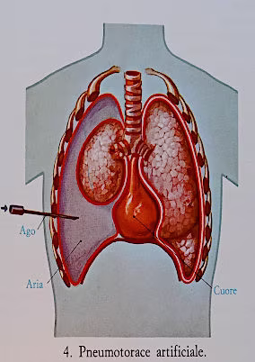 Ventilazione polmonare