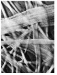Fibre del derma